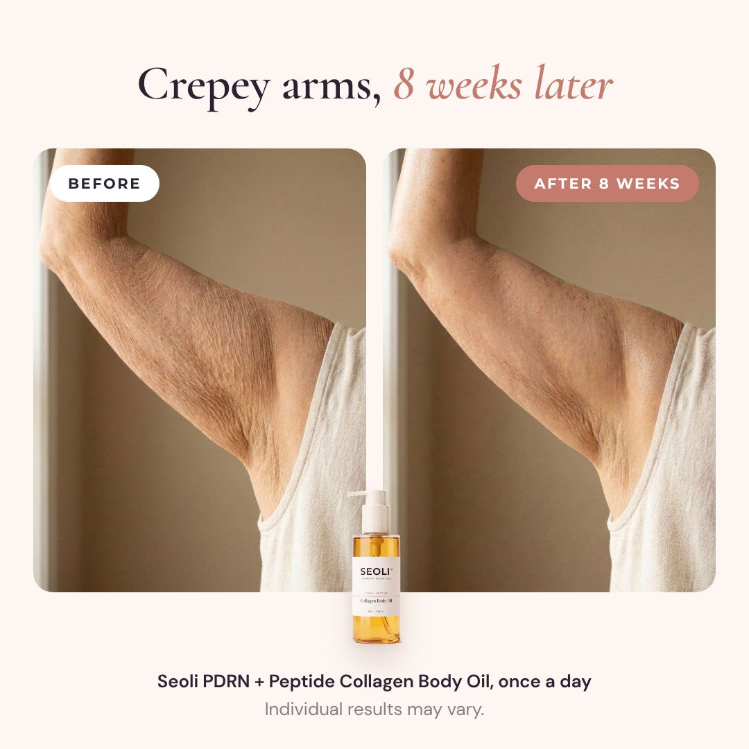 Crepey arms before and after 8 weeks